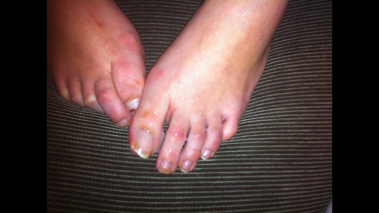 Cover bestfootjobs - RAW NATURAL TOES LONG TOENAILS - PHOTO VIDEO - ManyVids